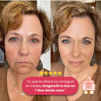 Elimina las Arrugas en 7 Días ¡1 + 1 GRATIS!