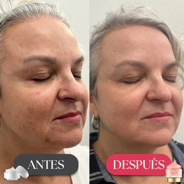 Elimina las Arrugas en 7 Días ¡1 + 1 GRATIS!