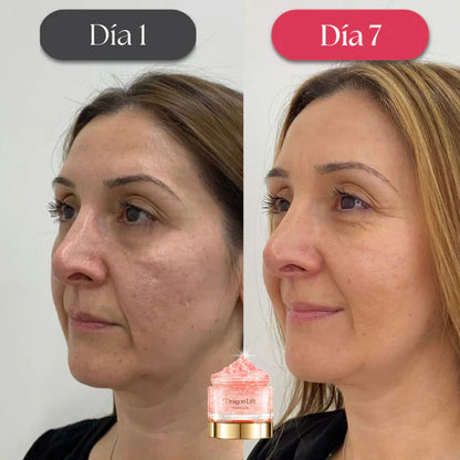 Elimina las Arrugas en 7 Días ¡1 + 1 GRATIS!